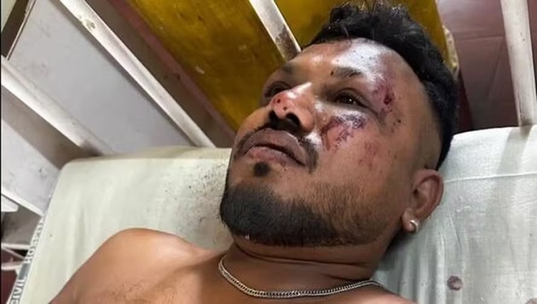 Acidente Aéreo na Índia: Único Sobrevivente Relata o Momento de Fuga e o “Milagre” de Estar Vivo